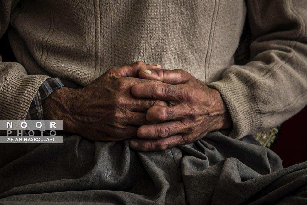 قسمتی از بدن قطع عضو قربانیان آلوده به میادین مین در مریوان کردستان