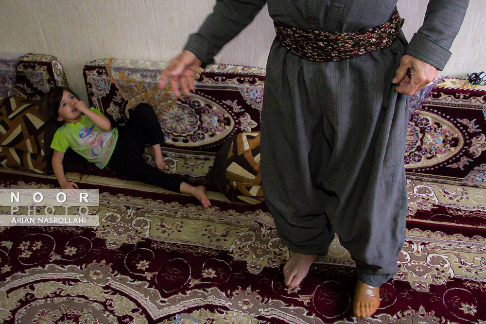 یکی از قربانیان آلوده به میادین مین که از شهروندان کرد در مریوان کردستان است.
