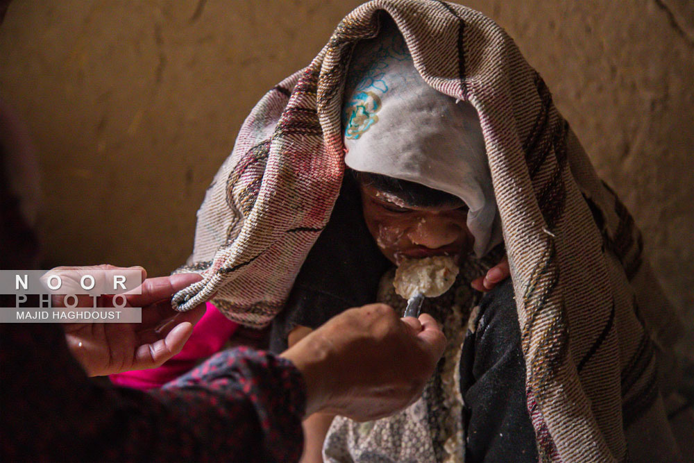 معلول جسمی و ذهنی حاصل ازدواج فامیلی در شهر محروم و مرزی مراوه تپه استان گلستان 